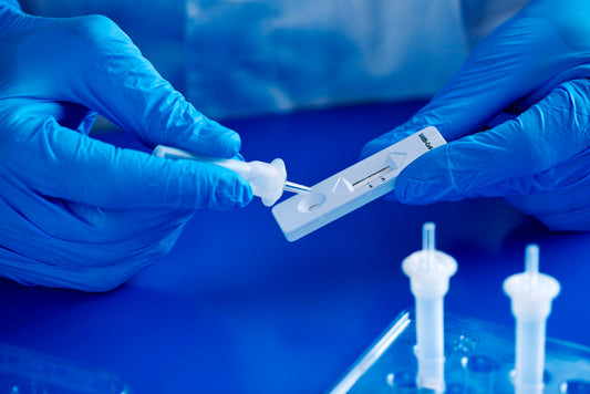 Point of Care Testing (POCT)
