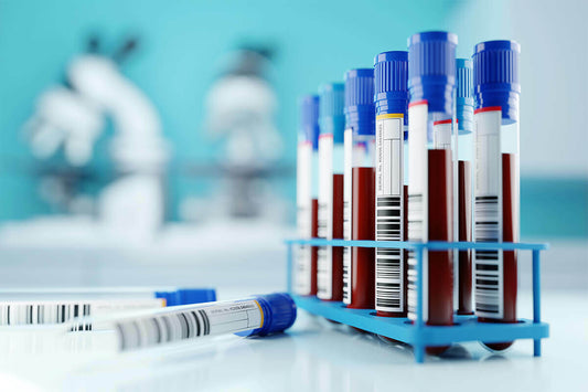 Titers Test